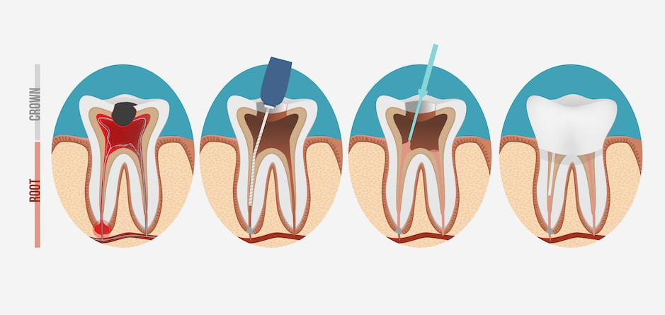 Pediatric Dentistry in Nadiad